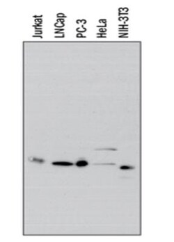 IkB-alpha Antibody (6A920) - BSA Free, Novus Biologicals 0.1mg; Unlabeled:Antibodies,