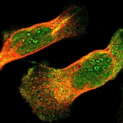 IkB-epsilon Antibody, Novus Biologicals:Antibodies:Primary Antibodies