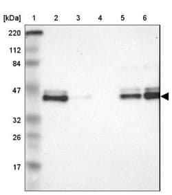 IkB-epsilon Antibody, Novus Biologicals:Antibodies:Primary Antibodies