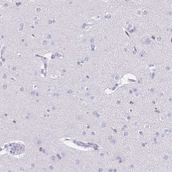 Ikaros/IKZF1 Antibody, Novus Biologicals:Antibodies:Primary Antibodies