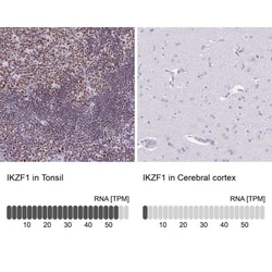 Ikaros/IKZF1 Antibody, Novus Biologicals:Antibodies:Primary Antibodies