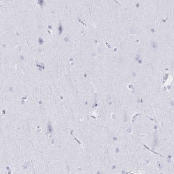 Ikaros/IKZF1 Antibody, Novus Biologicals 0.1mL; Unlabeled:Antibodies, Polyclonal
