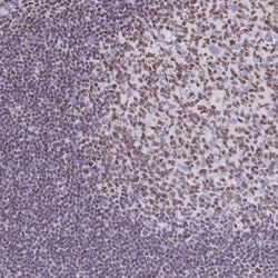 Ikaros/IKZF1 Antibody, Novus Biologicals 0.1mL; Unlabeled:Antibodies, Polyclonal