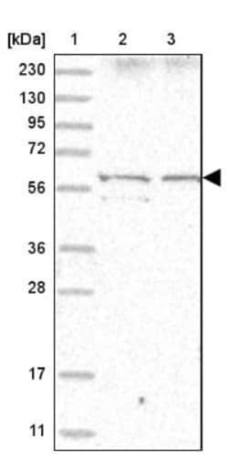 Ikaros/IKZF1 Antibody, Novus Biologicals 0.1mL; Unlabeled:Antibodies, Polyclonal