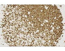 Novus Biologicals&trade;&nbsp;ImmPRESS(TM) HRP Horse anti-Mouse IgG PLUS Polymer, Peroxidase Kit