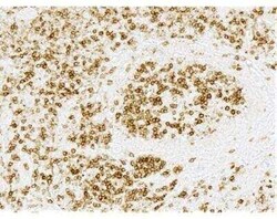 Novus Biologicals ImmPRESS(TM) HRP Horse anti-Rabbit IgG PLUS Polymer, Peroxidase Kit 1 Kit | Buy Online | Novus Biologicals&trade; | Fisher Scientific