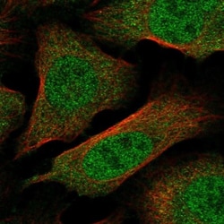 Importin alpha 5/KPNA1/SRP1 Antibody, Novus Biologicals 25 &mu;L; Unlabeled:Antibodies,