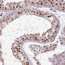 Importin alpha 5/KPNA1/SRP1 Antibody, Novus Biologicals 25 &mu;L; Unlabeled:Antibodies,