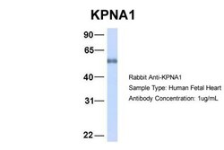 Importin alpha 5/KPNA1/SRP1 Antibody, Novus Biologicals:Antibodies:Primary