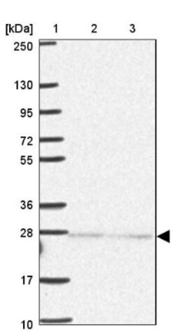 Importin alpha 5/KPNA1/SRP1 Antibody, Novus Biologicals 25 &mu;L; Unlabeled:Antibodies,