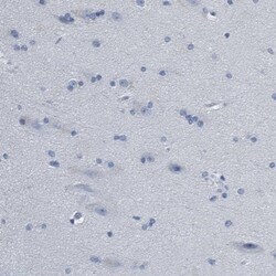 Indoleamine 2,3-dioxygenase/IDO Antibody, Novus Biologicals:Antibodies:Primary