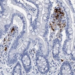 Indoleamine 2,3-dioxygenase/IDO Antibody, Novus Biologicals:Antibodies:Primary