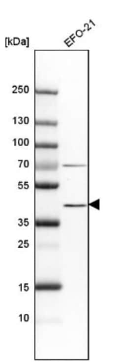Indoleamine 2,3-dioxygenase/IDO Antibody, Novus Biologicals:Antibodies:Primary