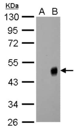 Influenza A H1N1 Neuraminidase Antibody - (A/WSN/1933), Novus Biologicals