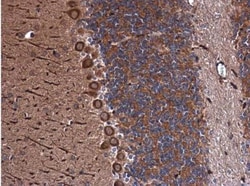 Inhibin alpha Antibody, Novus Biologicals 0.1mL; Unlabeled:Antibodies,