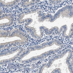 Inhibin alpha Antibody, Novus Biologicals 25 &mu;L; Unlabeled:Antibodies,