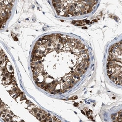 Inhibin alpha Antibody, Novus Biologicals 25 &mu;L; Unlabeled:Antibodies,