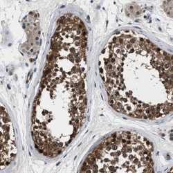 Inorganic Pyrophosphatase/PPA1 Antibody, Novus Biologicals 0.1mL; Unlabeled:Antibodies,