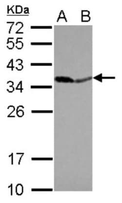 Inorganic Pyrophosphatase/PPA1 Antibody, Novus Biologicals 0.1mL; Unlabeled:Antibodies,