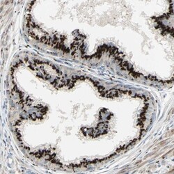 Inositol Monophosphatase 3/IMPAD1 Antibody, Novus Biologicals:Antibodies:Primary