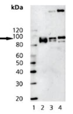 Insulin Receptor beta Antibody (C18C4), Novus Biologicals 0.05mg; Unlabeled:Antibodies,