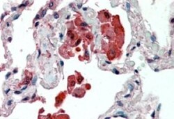 Insulysin/IDE Antibody, Novus Biologicals 0.1mg; Unlabeled:Antibodies,