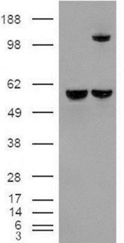 Insulysin/IDE Antibody, Novus Biologicals 0.1mg; Unlabeled:Antibodies,
