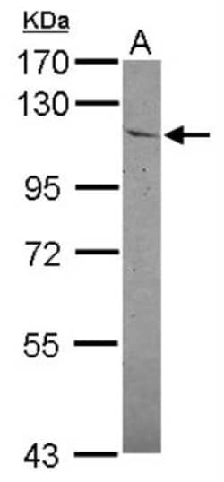 Insulysin/IDE Antibody, Novus Biologicals 0.1mL; Unlabeled:Antibodies,