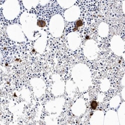 Integrin alpha 2b/CD41 Antibody, Novus Biologicals 0.1mL; Unlabeled:Antibodies,