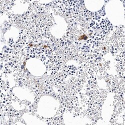 Integrin alpha 2b/CD41 Antibody, Novus Biologicals 0.1mL; Unlabeled:Antibodies,