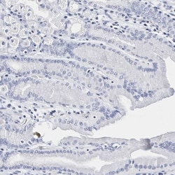 Integrin alpha 2b/CD41 Antibody, Novus Biologicals 0.1mL; Unlabeled:Antibodies,