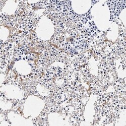 Integrin alpha 2b/CD41 Antibody, Novus Biologicals 25 &mu;L | Buy Online | Novus Biologicals | Fisher Scientific