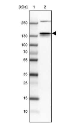 Integrin alpha 2b/CD41 Antibody, Novus Biologicals 0.1mL; Unlabeled:Antibodies,