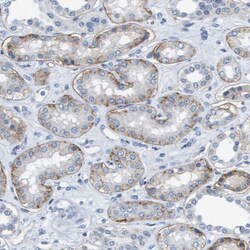 Integrin alpha 6/CD49f Antibody, Novus Biologicals:Antibodies:Primary Antibodies