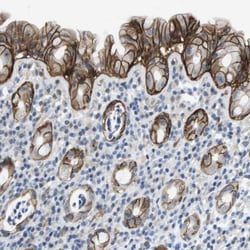 Integrin alpha 6/CD49f Antibody, Novus Biologicals:Antibodies:Primary Antibodies