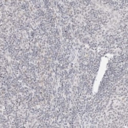 Integrin alpha 6/CD49f Antibody, Novus Biologicals 25 &mu;L; Unlabeled:Antibodies,