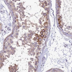 Integrin alpha E/CD103 Antibody, Novus Biologicals 0.1 mL | Buy Online | Novus Biologicals | Fisher Scientific