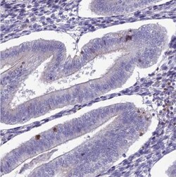 Integrin alpha E/CD103 Antibody, Novus Biologicals 0.1 mL | Buy Online | Novus Biologicals | Fisher Scientific