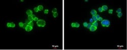Integrin alpha L/CD11a Antibody, Novus Biologicals 0.1mL; Unlabeled:Antibodies,