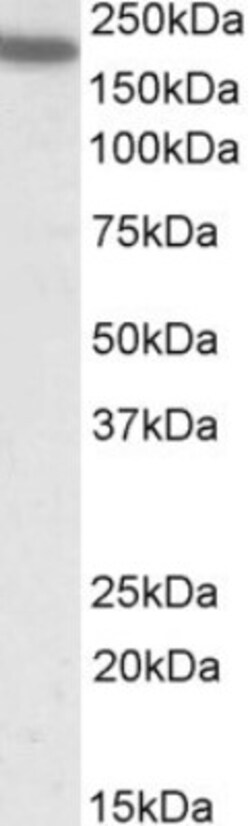 Integrin alpha L/CD11a Antibody, Novus Biologicals 0.1mg; Unlabeled:Antibodies,