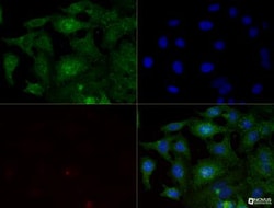 Integrin beta 1/CD29 Antibody (P4C10) - BSA Free, Novus Biologicals:Antibodies:Primary