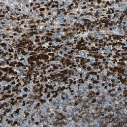 Integrin beta 2/CD18 Antibody, Novus Biologicals 0.1mL; Unlabeled:Antibodies,