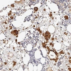Integrin beta 3/CD61 Antibody, Novus Biologicals:Antibodies:Primary Antibodies