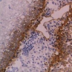 Integrin beta 4/CD104 Antibody (450-9D) - BSA Free, Novus Biologicals 0.1mg;