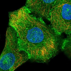 Integrin beta 4/CD104 Antibody, Novus Biologicals:Antibodies:Primary Antibodies