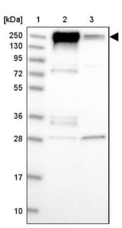 Integrin beta 4/CD104 Antibody, Novus Biologicals:Antibodies:Primary Antibodies