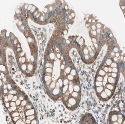 Integrin beta-like protein 1 Antibody, Novus Biologicals 25 &mu;L; Unlabeled:Antibodies,