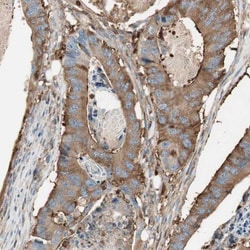Integrin beta-like protein 1 Antibody, Novus Biologicals 25 &mu;L; Unlabeled:Antibodies,