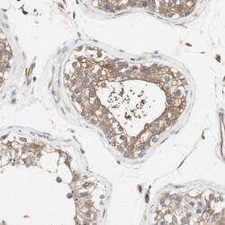 Integrin beta-like protein 1 Antibody, Novus Biologicals 25 &mu;L; Unlabeled:Antibodies,