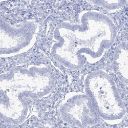 Intra Acrosomal Protein Antibody, Novus Biologicals:Antibodies:Primary